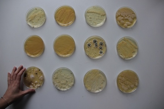 Human Cheese